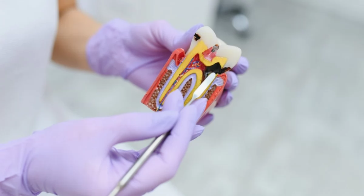 Zdrowie, endodoncja kiedy konieczna - zdjęcie, fotografia